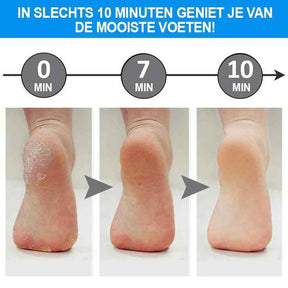 other : Elektrische Pedicureset Voeten - Eeltverwijderaar - 3 Opzetstukken in van Pantino